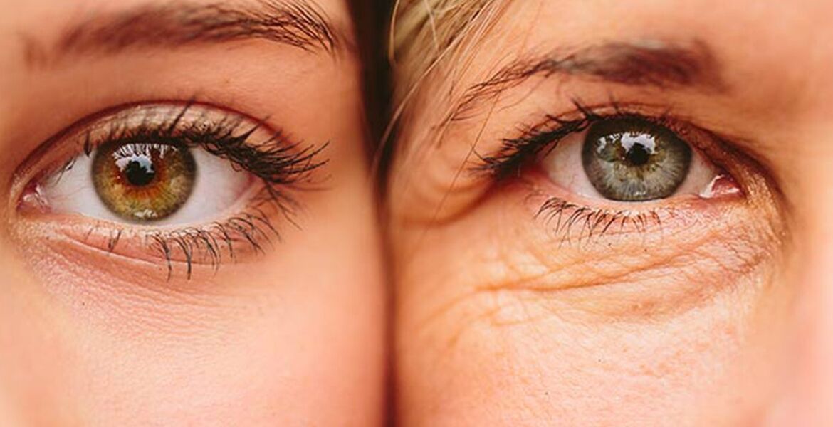 Vanjski znakovi starenja kože oko očiju u dvije žene različite dobi