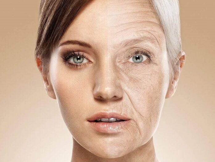 koža lica prije i nakon laserskog pomlađivanja